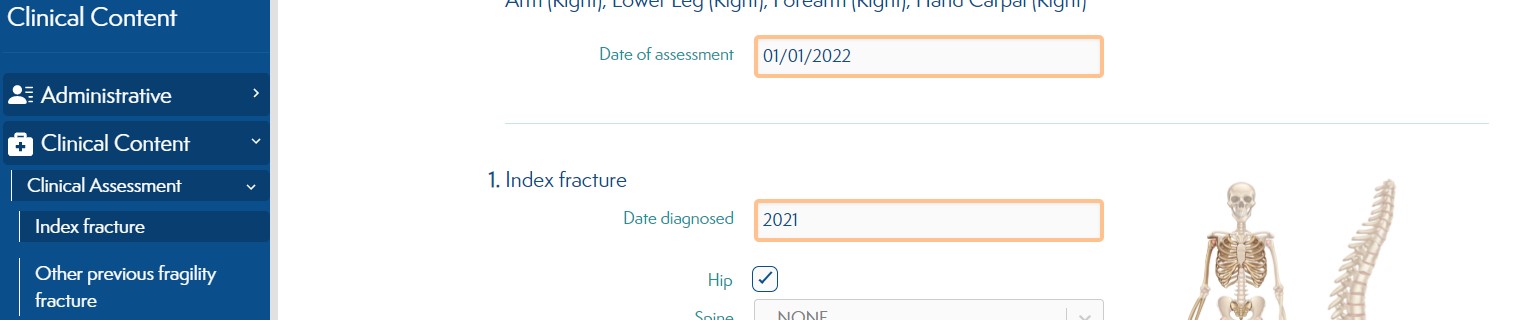 checkboxhip.jpg